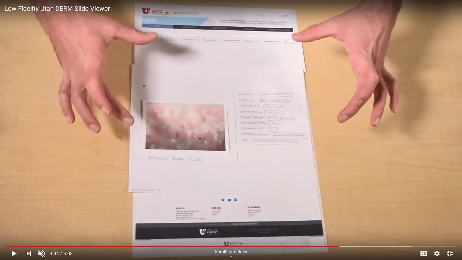 Screenshot of the UtahDERM Low Fidelity Prototype