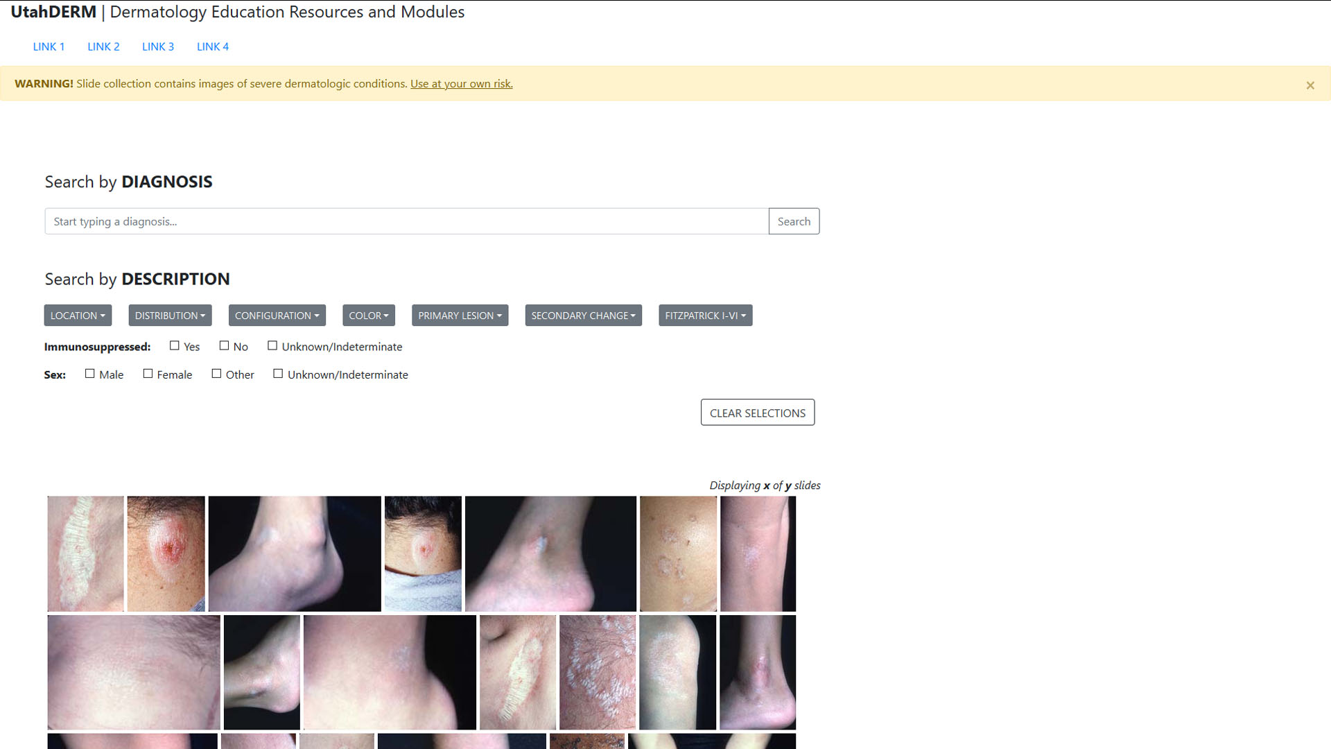 Screenshot of the UtahDERM Web Prototype